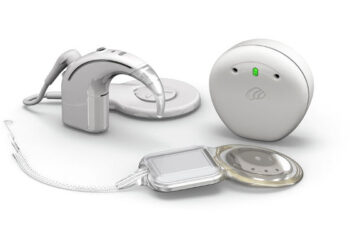 Cochlear Nucleus Nexa System